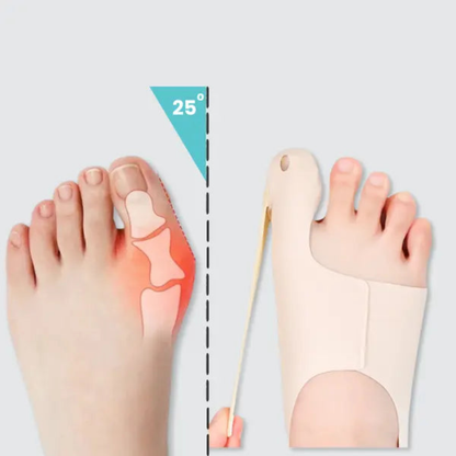 Bunion Corrector Comfort Sleeve
